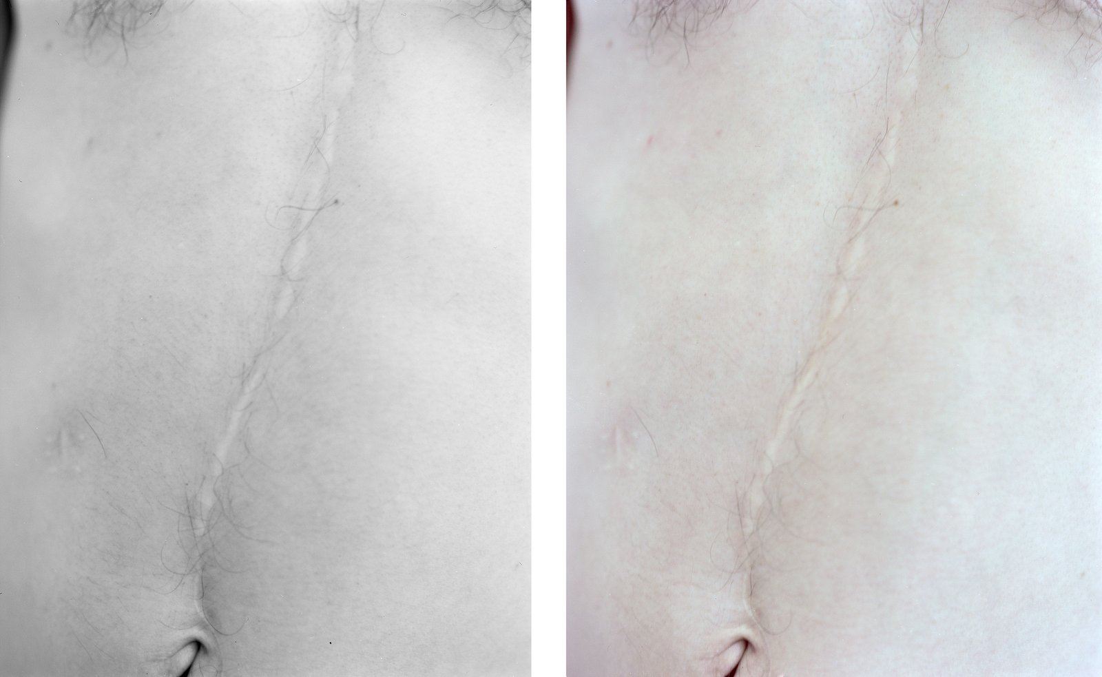 Nicolas Leroy | Adrien Torse 2